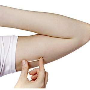 Implant-Contraceptive